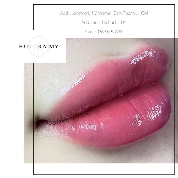 Bui Tra My BeautyClinic – Hình ảnh 1