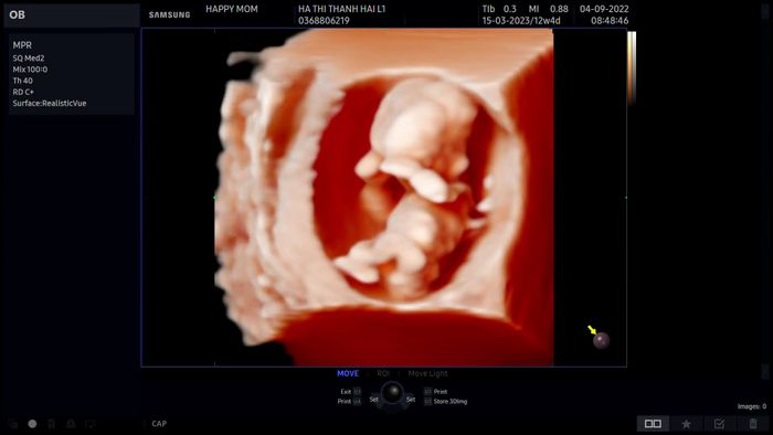 Không gian thăm khám hiện đại tại HappyMom Ninh Bình