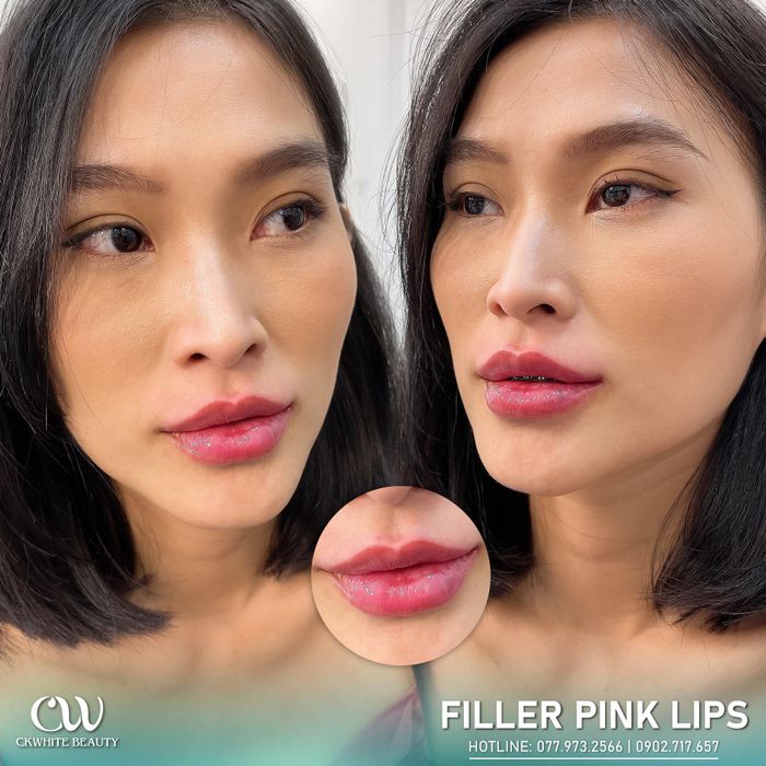 Viện Thẩm Mỹ CKWhite Beauty – Hình ảnh 1