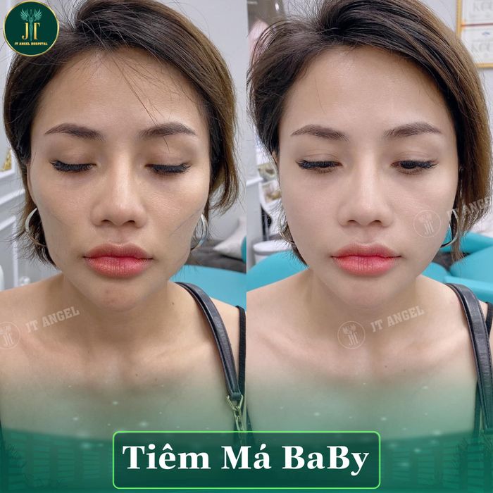 Bệnh Viện Thẩm Mỹ JT Angel – Hình ảnh 2