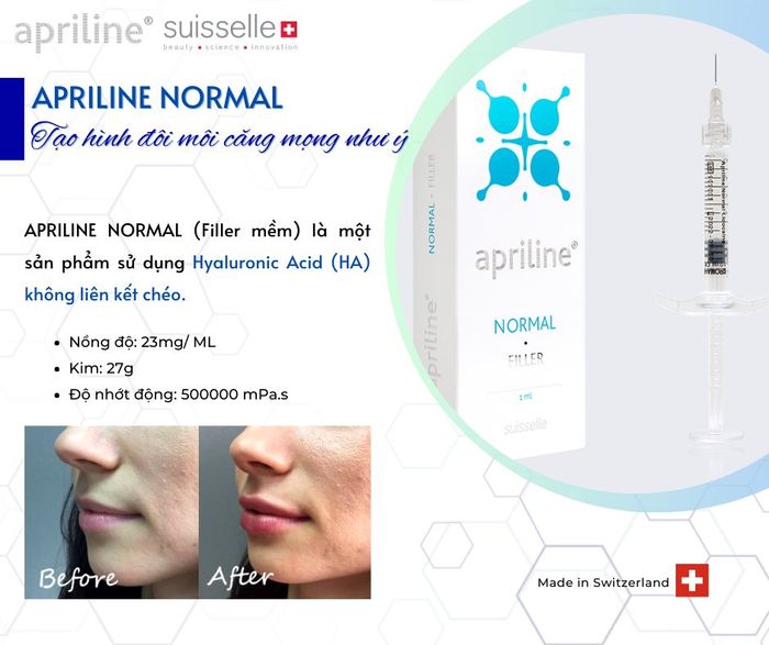 Hình ảnh minh họa Filler Apriline (2)