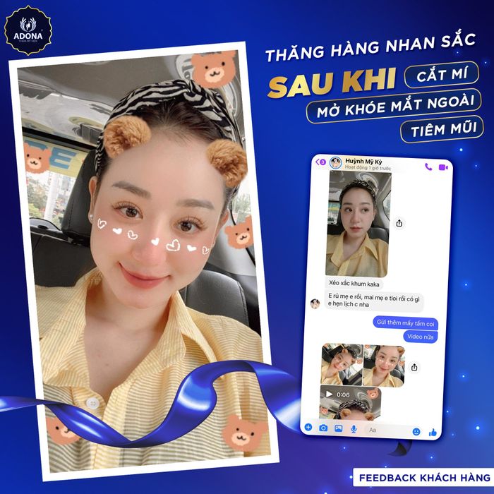 Thẩm Mỹ Viện ADONA – Hình ảnh 2