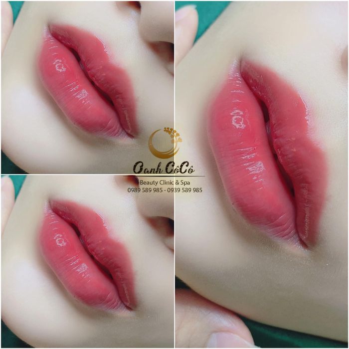 Oanh CôCô Beauty Clinic & Spa – Hình ảnh 1