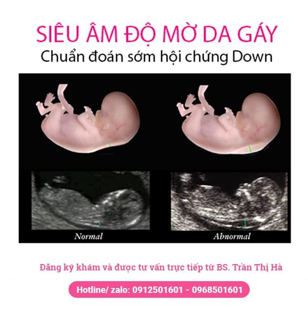 Bộ sưu tập hình ảnh chân thực về quy trình khám thai chuyên nghiệp tại Phòng khám Bác sĩ Trần Thị Hà