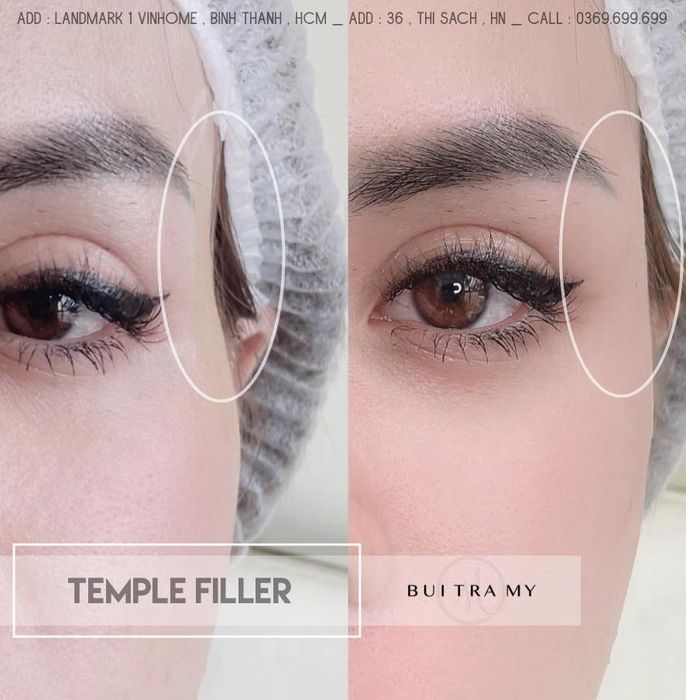 Bui Tra My BeautyClinic – Hình ảnh 2