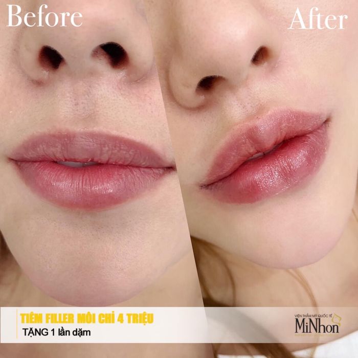 Viện thẩm mỹ quốc tế Minhon – Hình ảnh 1