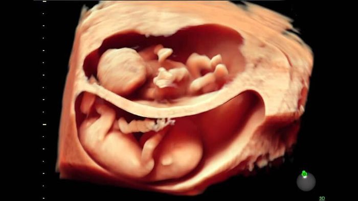 Đội ngũ y bác sĩ chuyên môn cao tại Khoa Phụ Sản