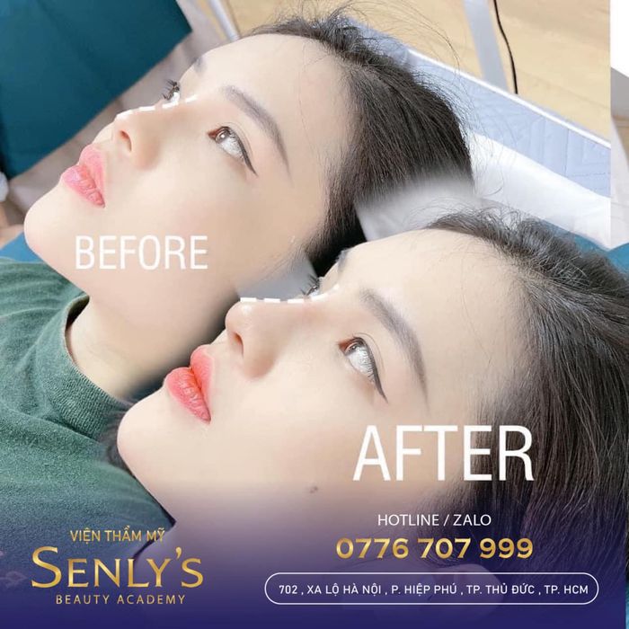 Không gian sang trọng tại Thẩm Mỹ Senly
