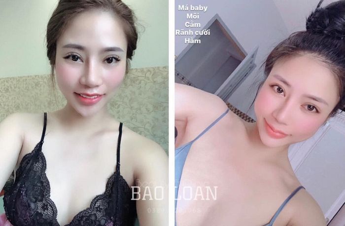 Hình ảnh thực tế dịch vụ tại Bảo Loan Beauty
