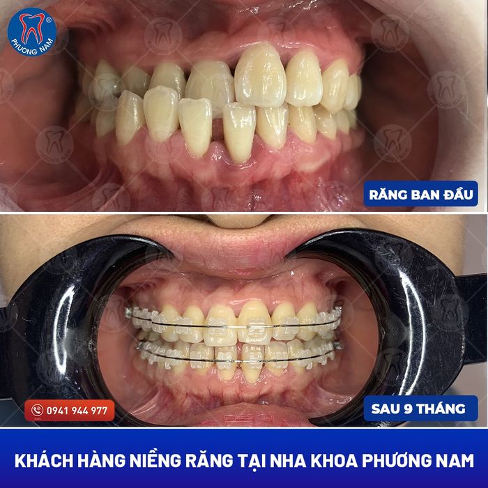 Hình ảnh hệ thống máy móc hiện đại tại Nha Khoa Phương Nam
