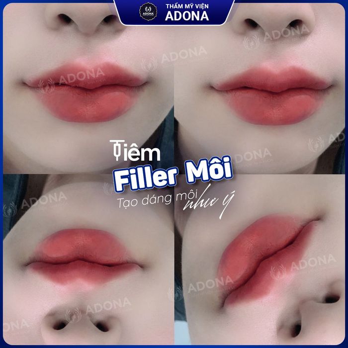 Hình ảnh Thẩm Mỹ Viện ADONA