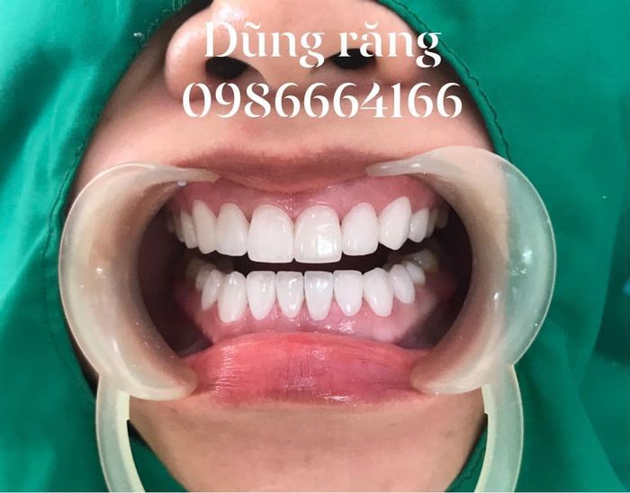 Hình ảnh cơ sở vật chất hiện đại tại Nha Khoa Hà Nội