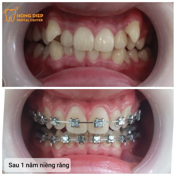 Hình ảnh đội ngũ y bác sĩ chuyên nghiệp tại Nha Khoa Hồng Điệp