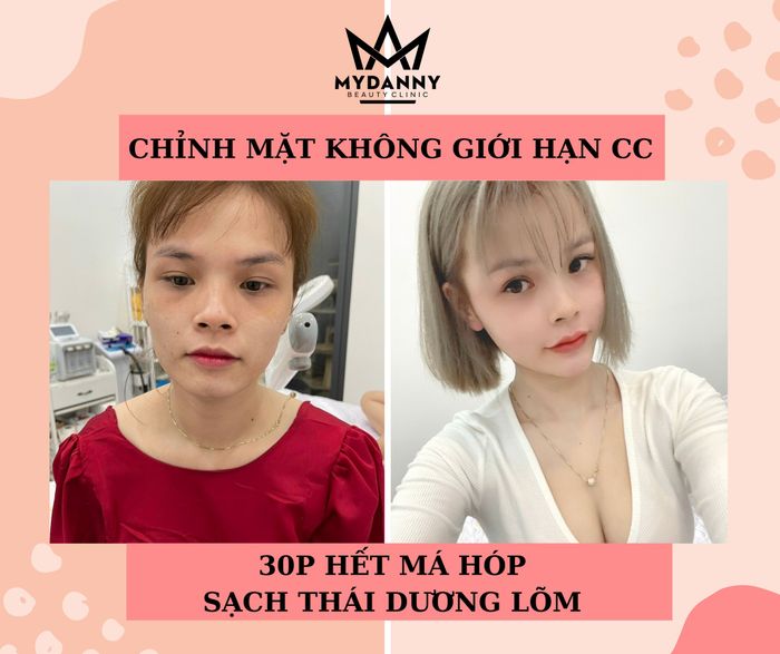 Hình ảnh thực tế tại Mydanny Beauty Clinic