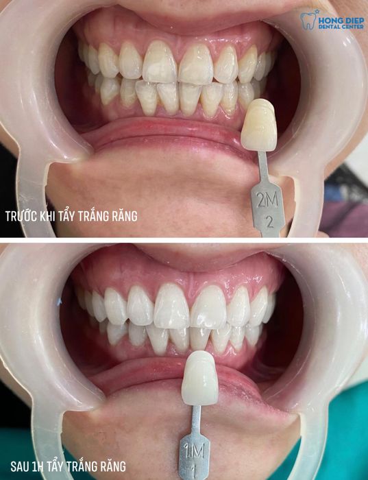 Hình ảnh phòng khám hiện đại tại Nha Khoa Hồng Điệp