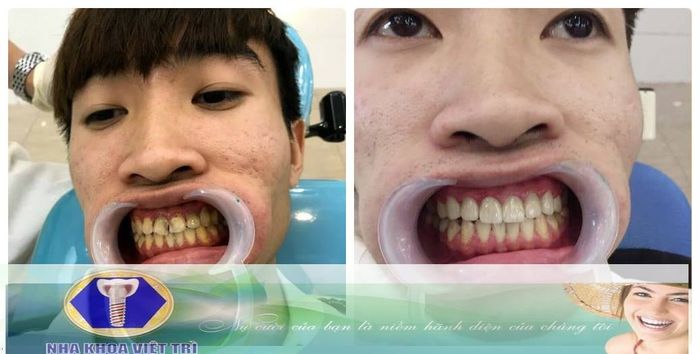 Hình ảnh phòng khám Nha Khoa Việt Trì - Bác sĩ Hưng