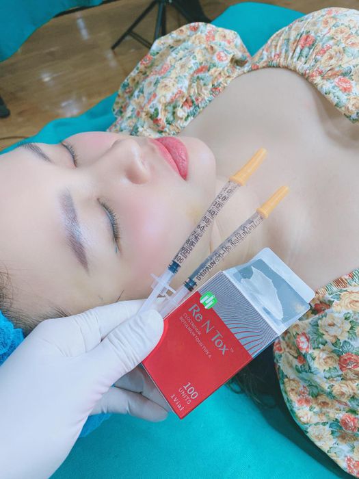 Hình ảnh kết quả thực tế tại Oanh CôCô Beauty Clinic & Spa