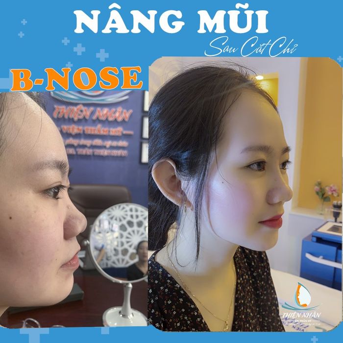 Hình ảnh Viện Thẩm Mỹ Bác Sĩ Trần Thiện Nhân (Ảnh 2)
