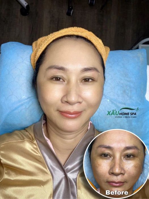 Hình ảnh Xấu Home Spa 1