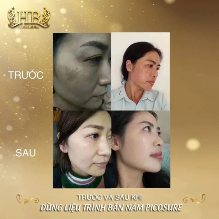 Hình ảnh HB Spa - Quận 3 2