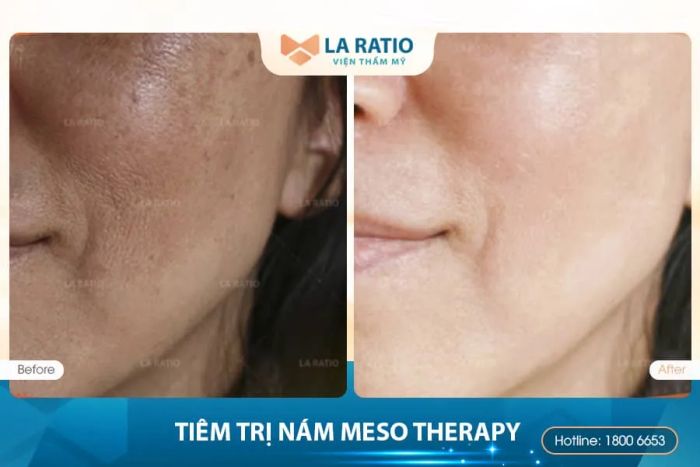 Hình ảnh Viện Thẩm Mỹ La Ratio 2
