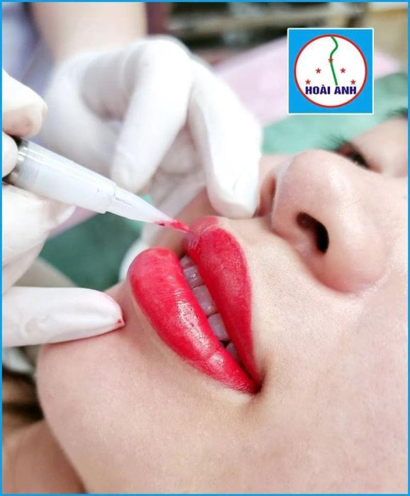 Hình ảnh thực tế về không gian sang trọng tại Thẩm Mỹ Viện Hoài Anh