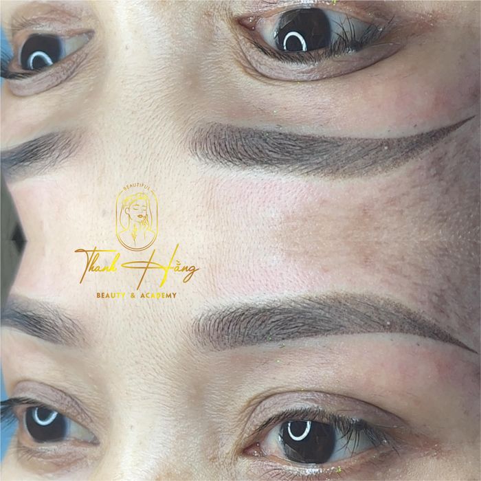 Hình ảnh thực tế khách hàng tại Thanh Hằng Beauty - Ảnh 2