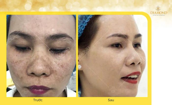 Hình ảnh Thẩm Mỹ Diamond 2
