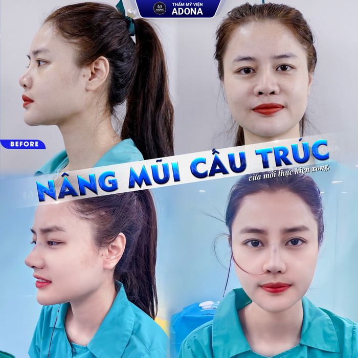 Hình ảnh Thẩm Mỹ Viện ADONA
