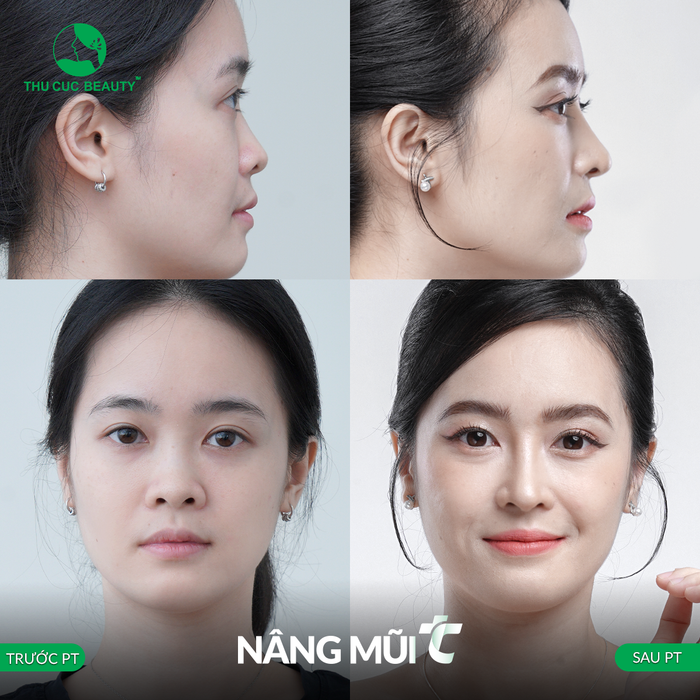 Không gian sang trọng tại Bệnh Viện Thẩm Mỹ Thu Cúc