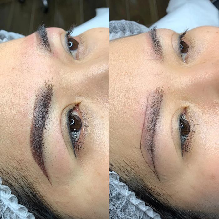 Quỳnh Anh Beauty - Bộ sưu tập hình ảnh 2: Hành trình thay đổi diện mạo ấn tượng