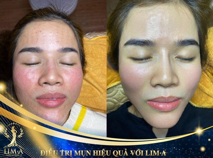 Hình ảnh phòng khám da liễu LimA Vũng Tàu