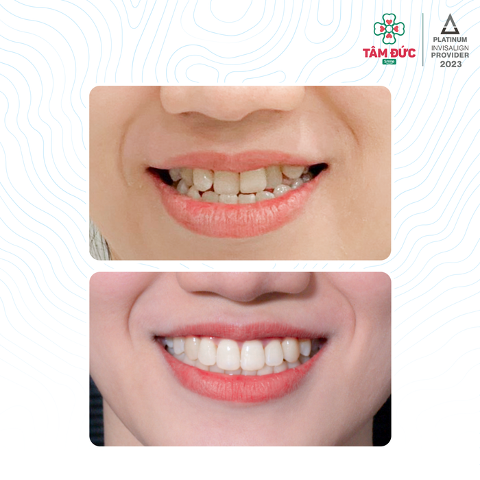 Hình ảnh không gian hiện đại tại Nha khoa Tâm Đức