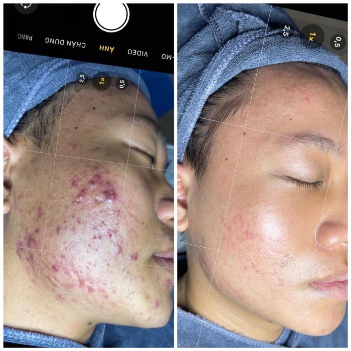 Viện Thẩm Mỹ Quốc Tế EVA - Quảng Ngãi (Hình ảnh ấn tượng)