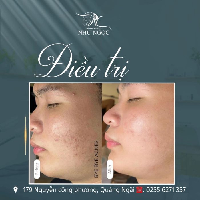 Quy trình trị liệu chuyên nghiệp tại Ngọc Beauty Spa & Clinic (Ảnh 2)