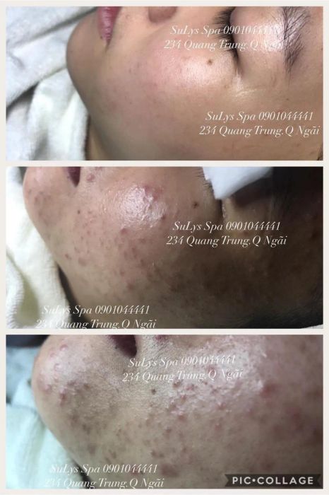 SuLy Spa - Hình ảnh thực tế về quy trình chăm sóc da chuyên nghiệp