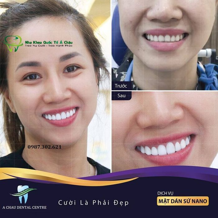 Nha Khoa Quốc Tế Á Châu – Ảnh 2