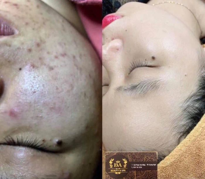 Không gian sang trọng tại Viện Thẩm Mỹ Quốc Tế EVA (Ảnh 1)