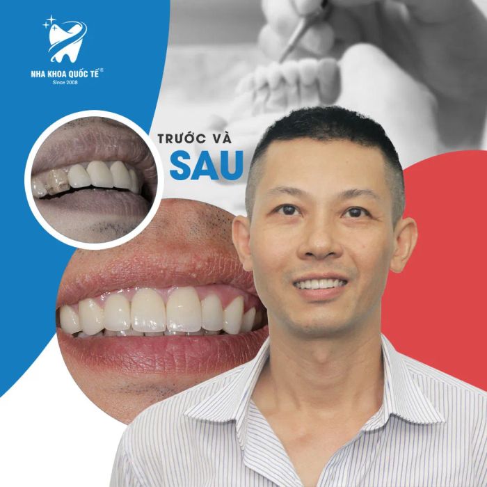 Trung Tâm Nha Khoa Quốc Tế hình ảnh 2