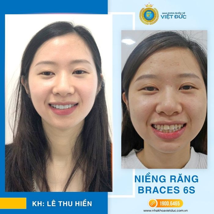 Nha khoa Việt Đức – Ảnh 2