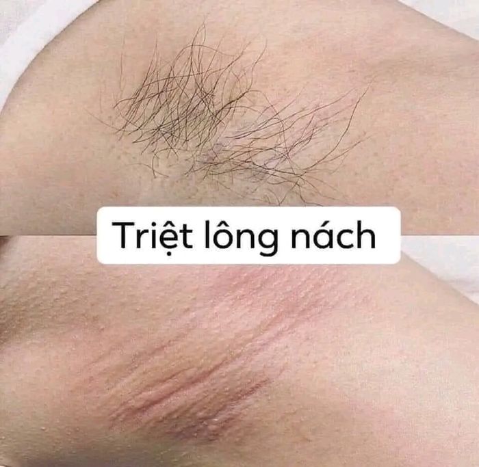 Hệ thống máy móc hiện đại nhập khẩu châu Âu tại Beauty Hà Nội - Thanh Hoá