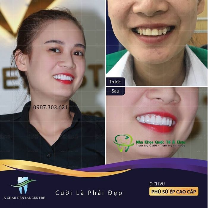 Nha Khoa Quốc Tế Á Châu – Ảnh 1