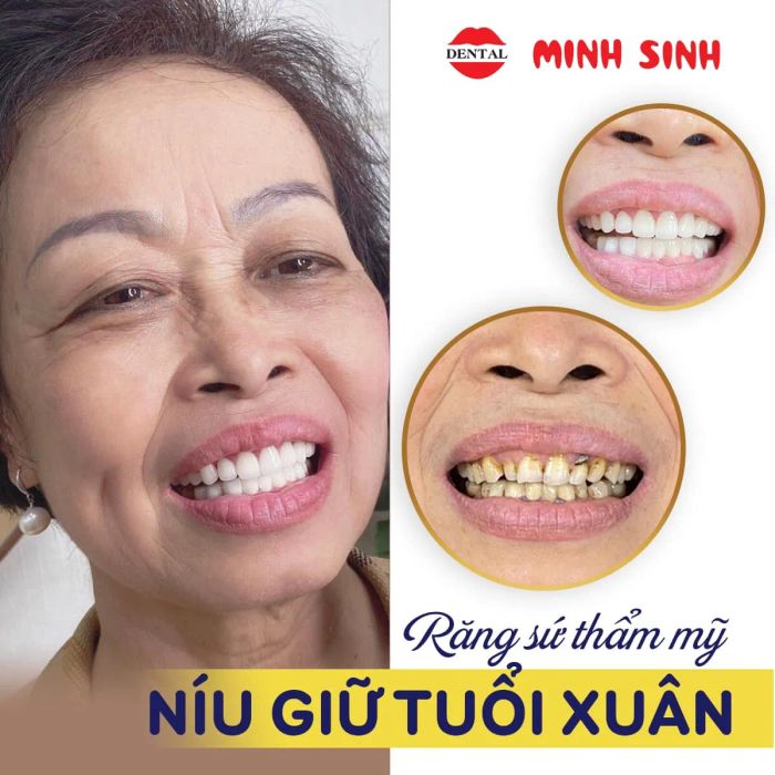 NHA KHOA MINH SINH hình ảnh 1