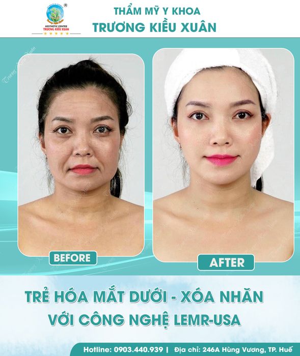 Hình ảnh thực tế về quy trình thẩm mỹ tại Bệnh viện Thẩm mỹ Trương Kiều Xuân