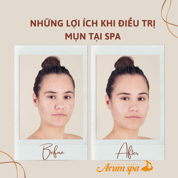 Arum Spa - Chăm Sóc & Làm Đẹp với hình ảnh tuyệt mỹ