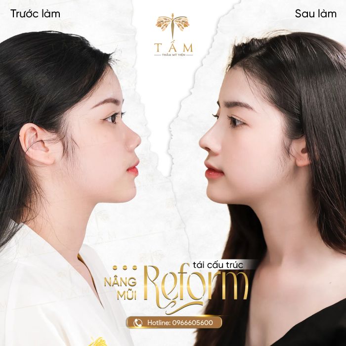 Thẩm Mỹ Viện Tấm - Nơi kiến tạo nét đẹp chuẩn y khoa