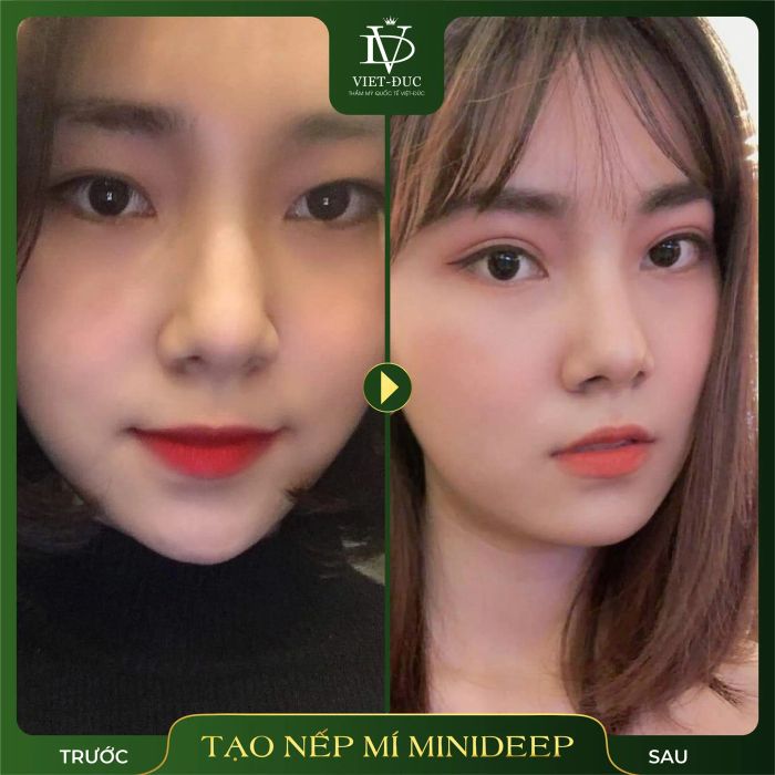 Thẩm Mỹ Quốc Tế Việt Đức hình ảnh 1