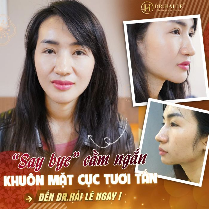 Viện Thẩm Mỹ Y Khoa Dr.Hải Lê - Nơi gửi gắm niềm tin vàng