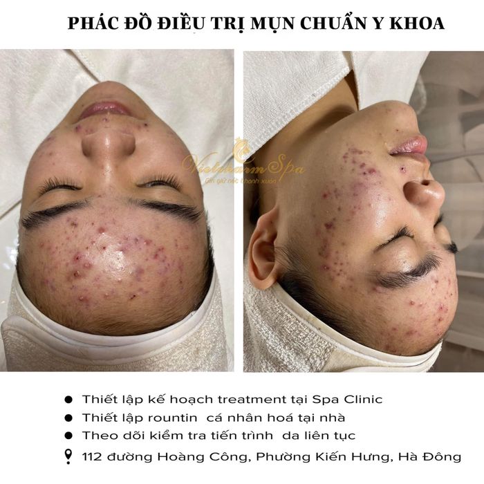 Không gian sang trọng và hiện đại tại VietCharm Spa & Clinic