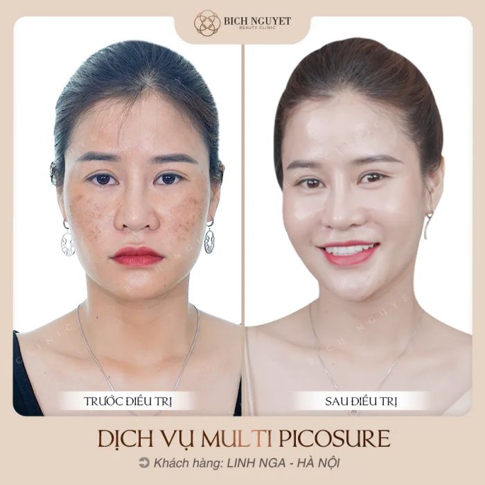 Bich Nguyet Beauty Clinic - Không gian trị liệu sang trọng với công nghệ hàng đầu